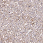 Immunohistochemical staining of human liver shows weak membranous positivity in hepatocytes.
