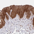 Immunohistochemical staining of human urinary bladder shows moderate to strong membranous positivity in urothelial cells.