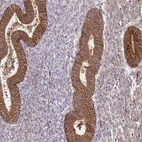 Immunohistochemical staining of human endometrium shows moderate to strong membranous positivity in glandular cells.