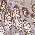 Immunohistochemical staining of human rectum shows moderate to strong membranous positivity in glandular cells.