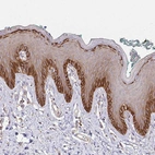 Immunohistochemical staining of human skin shows moderate to strong membranous positivity in squamous epithelial cells.