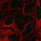 Anti-IGHMBP2 Antibody