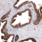 Immunohistochemical staining of human prostate shows strong membranous positivity in glandular cells.