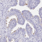 Anti-AKAP14 Antibody