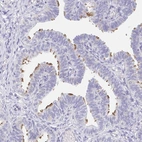 Immunohistochemical staining of human fallopian tube shows high expression.