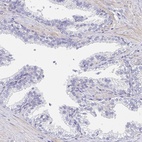 Immunohistochemical staining of human prostate shows low expression as expected.