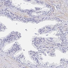 Immunohistochemical staining of human prostate shows low expression as expected.