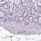 Immunohistochemical staining of human small intestine shows moderate cytoplasmic positivity in peripheral ganglion.