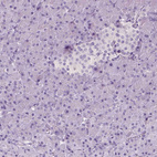 Immunohistochemical staining of human pancreas shows no positivity in exocrine glandular cells as expected.