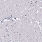 Immunohistochemical staining of human skeletal muscle shows no positivity in myocytes as expected.