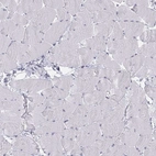 Immunohistochemical staining of human skeletal muscle shows no positivity in myocytes as expected.