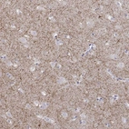 Immunohistochemical staining of human caudate shows moderate positivity in neuropil.