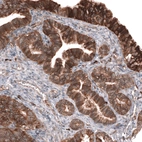 Immunohistochemical staining of human fallopian tube shows strong membranous positivity in glandular cells.