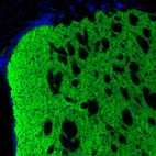 Immunofluorescence staining of mouse caudate putamen shows synaptic immunoreactivity.