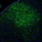 Anti-TH Antibody