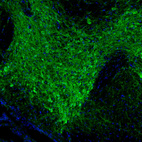 Immunofluorescence staining of mouse midbrain shows positive processes and cell bodies.