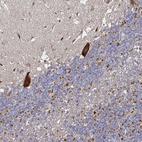 Anti-NRSN1 Antibody