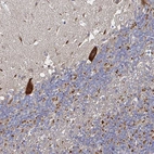 Anti-NRSN1 Antibody