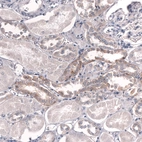 Immunohistochemical staining of human kidney shows weak to moderate membranous positivity in cells in tubules.