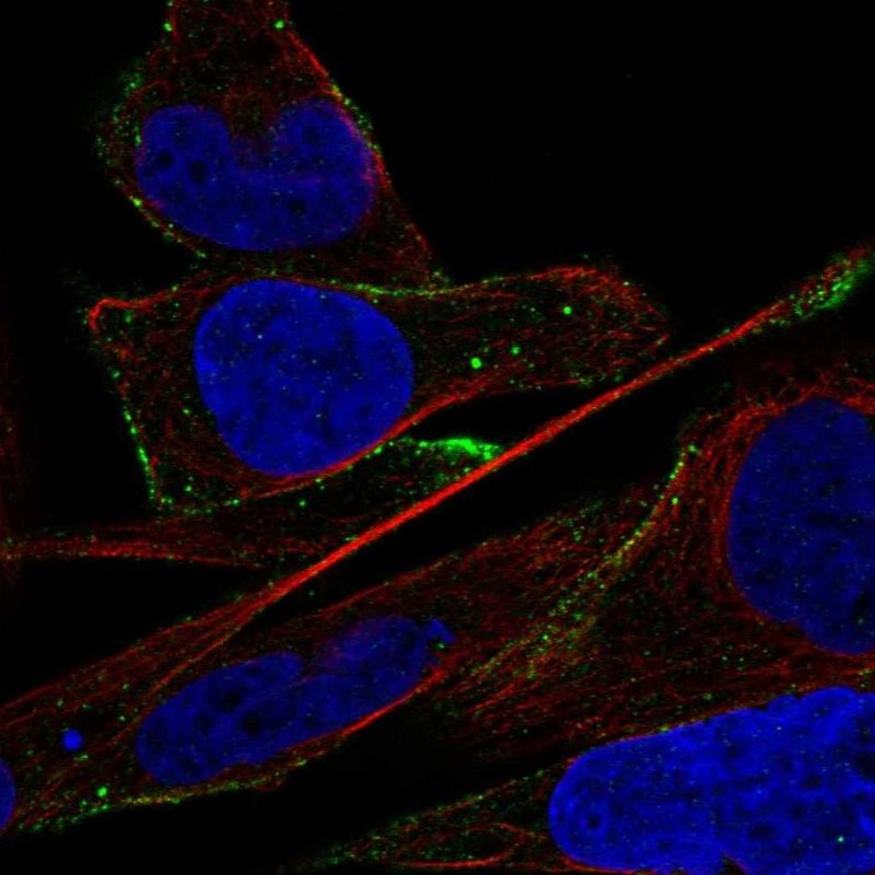 Anti-ADAMTS16 Antibody