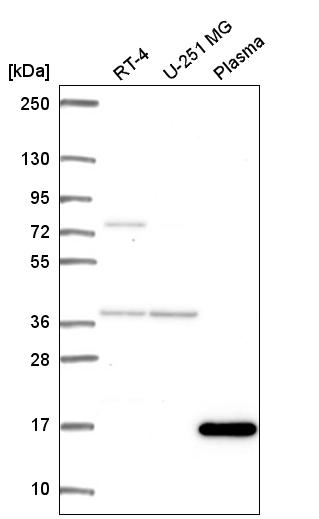 Anti-FOXL2NB Antibody