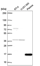 Anti-FOXL2NB Antibody