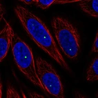 Immunofluorescent staining of human cell line SiHa shows localization to nucleoli fibrillar center.