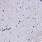 Immunohistochemical staining of human skeletal muscle shows no positivity in myocytes as expected.