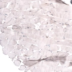 Immunohistochemical staining of human skeletal muscle shows no positivity in myocytes as expected.