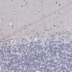 Immunohistochemical staining of human cerebellum shows no positivity in Purkinje cells as expected.