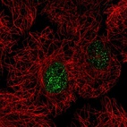 Immunofluorescent staining of human cell line A549 shows localization to nucleoplasm.