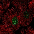 Immunofluorescent staining of human cell line A549 shows localization to nucleoplasm.