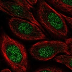 Immunofluorescent staining of human cell line SiHa shows localization to nucleus.