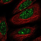 Anti-THRB Antibody