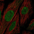 Anti-UBN1 Antibody