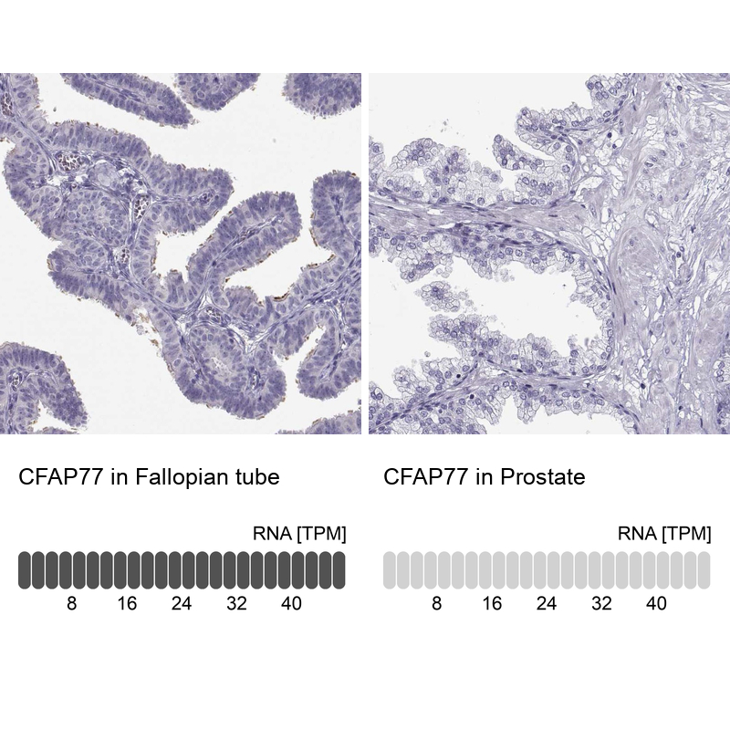 Anti-CFAP77 Antibody