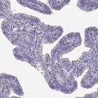 Immunohistochemical staining of human fallopian tube shows high expression.