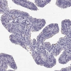 Immunohistochemical staining of human fallopian tube shows high expression.