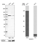 Western blot analysis in human cell lines RT-4 and PC-3 using Anti-ADAM10 antibody. Corresponding ADAM10 RNA-seq data are presented for the same cell lines. Loading control: Anti-PFN1