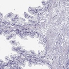 Immunohistochemical staining of human prostate shows low expression as expected.