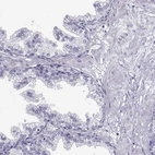 Immunohistochemical staining of human prostate shows low expression as expected.