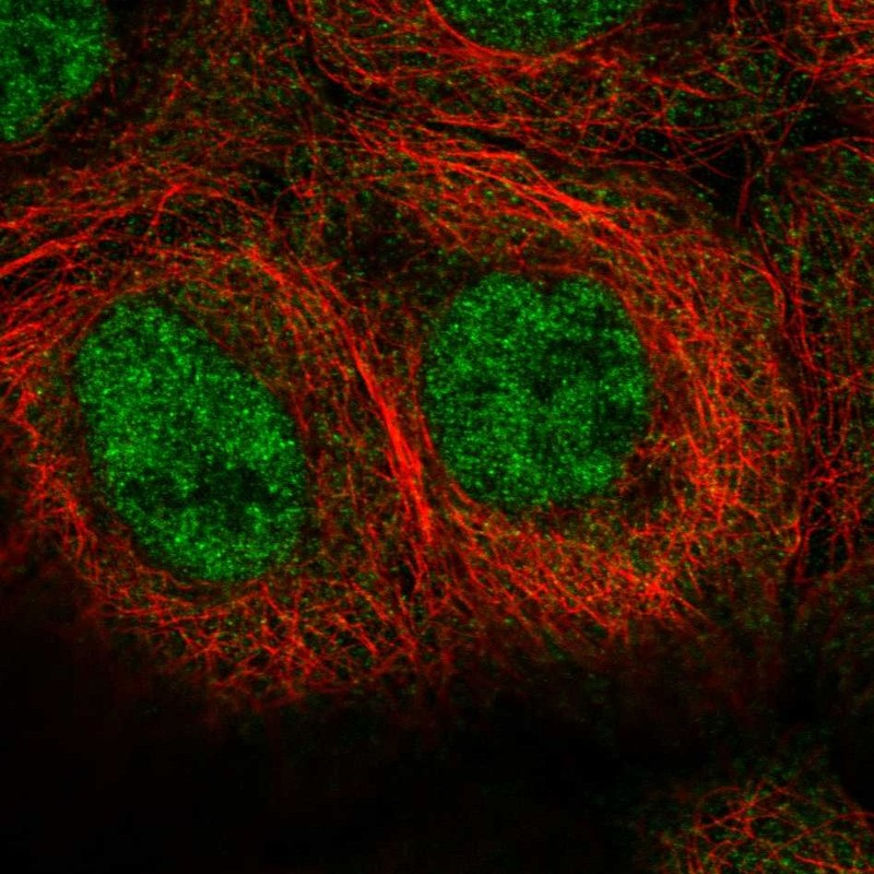 Anti-MINDY1 Antibody