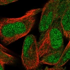Immunofluorescent staining of human cell line RH-30 shows localization to nucleoplasm & cytosol.