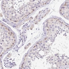 Immunohistochemical staining of human testis shows high expression.