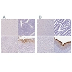 Immunohistochemical staining of human cerebral cortex, endometrium, liver and urinary bladder using Anti-UPK2 antibody HPA061106 (A) shows similar protein distribution across tissues to independent antibody HPA043312 (B).