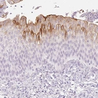 Immunohistochemical staining of human urinary bladder shows moderate membranous positivity in urothelial cells.