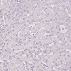 Immunohistochemical staining of human liver shows no positivity in hepatocytes as expected.