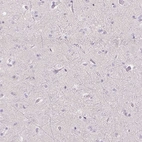 Immunohistochemical staining of human cerebral cortex shows no positivity in neurons as expected.