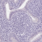 Immunohistochemical staining of human endometrium shows no positivity in glandular cells as expected.