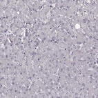 Anti-BICDL1 Antibody